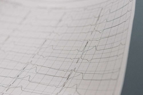 Neurofeedback 101